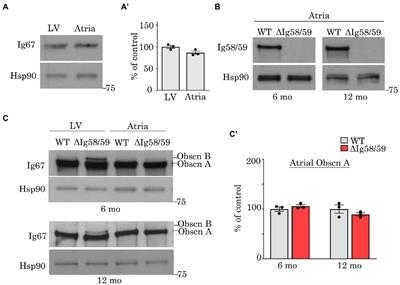 Alterations in cytoskeletal and Ca2+ cycling regulators in atria lacking the obscurin Ig58/59 module